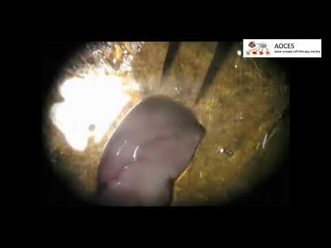 Micro-dissection of Rat Brain for RNA or Protein Extraction from Specific Brain Region