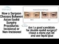 How to Choose Incisional or Non-Incisional Asian Double Eyelid Surgery