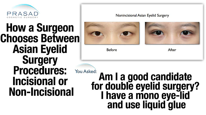 How to Choose Incisional or Non-Incisional Asian Double Eyelid Surgery - DayDayNews