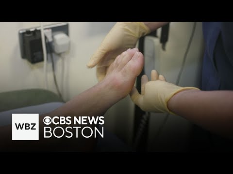 How to treat an ingrown toenail