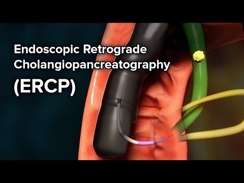 Pediatric ERCP | Cincinnati Children&rsquo;s