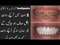 Challenge For Clean Dirty Teeth In 2 Mint  at Home | How To Clean Dirty Teeth Instantly Permanent