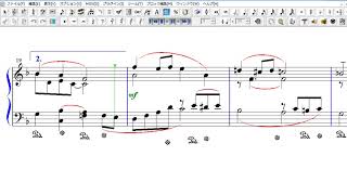 ホフマン　バラード　H.Hofmann Stimmungsbilder_Op.88 No.9