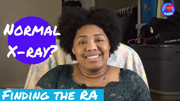 Can You Have RA and a Normal X-ray? | TESTS THAT VISIBLY SHOW THE RA