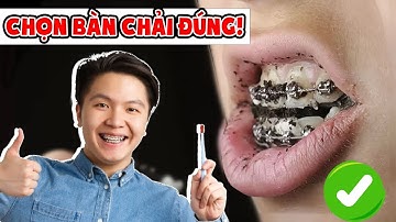 Bàn Chải Cho Người Niềng Răng: 3 Loại Bàn Chải Cho Người Niềng Răng "Đỉnh Nhất" (Đảm Bảo Sach Bong)