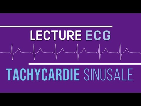 Vidéo: Une tachycardie sinusale inappropriée peut-elle disparaître ?