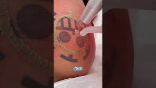 Why Tattoos Fade After Laser Treatment 🖋️ #shortfacts #viral