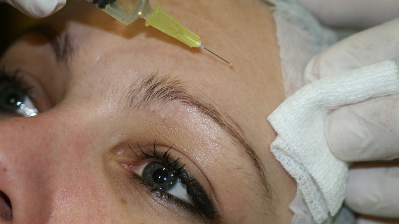 Мезотерапия - Спасение От Морщин. Сильный Метод?