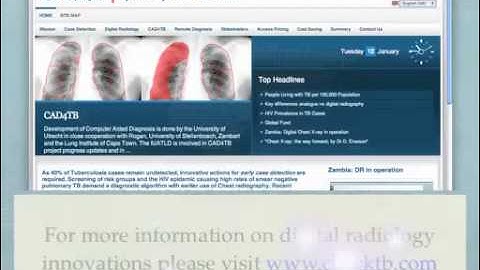 Digital Radiology for early TB case detection in Zambia