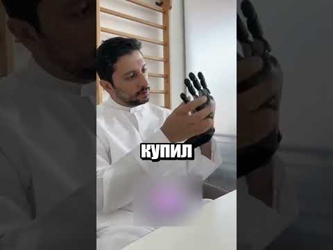 Не забывайте носить перчатки зимой