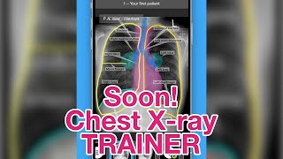 Learn how to interpret chest X-rays the cool way! screenshot 5