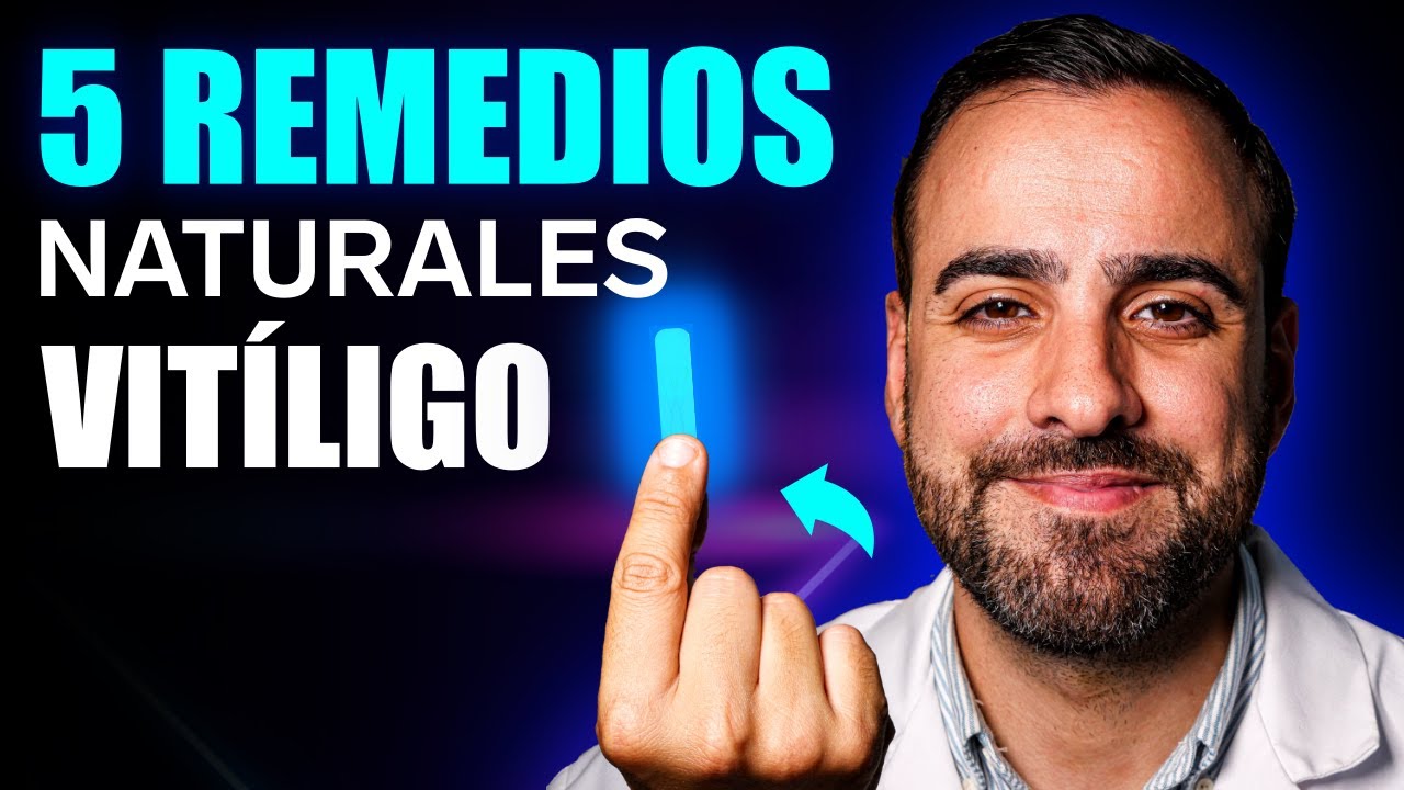 TOP 5 Remedios NATURALES para ACABAR con el VITILIGO