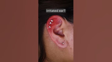 Irritated ear piercing hack #shorts.