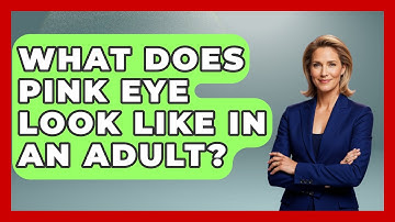 What Does Pink Eye Look Like In An Adult? - Optometry Knowledge Base