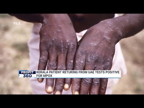 India Reports First