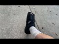 #2 - 1 Day Post-Surgery - Cheilectomy Surgery - Patient Recovery &amp; Review  Hallux Rigidus Big Toe