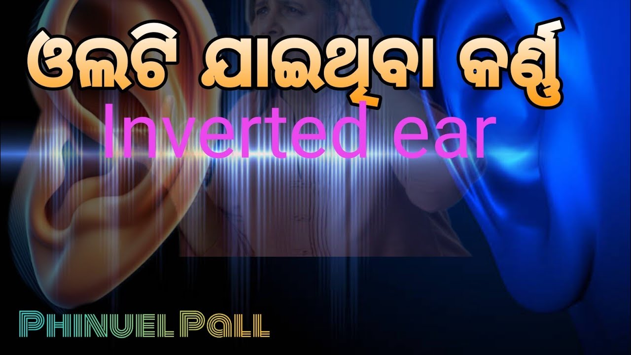 Inverted Ear ଓଲଟି ଯାଇଥିବା କର୍ଣ୍ଣ -Inverted ear - YouTube
