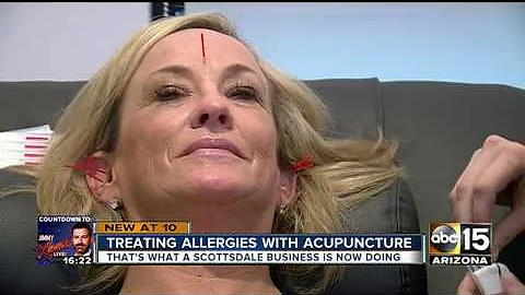 WHO KNEW? Acupuncture can help seasonal allergies - DayDayNews