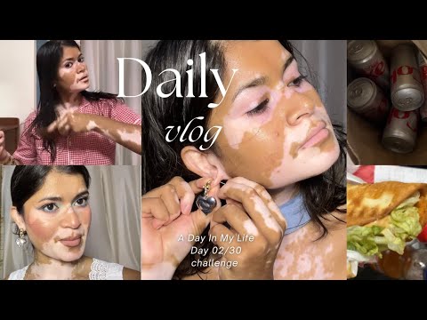 Daily vlog 02/30 😍 ek kand ho Gaya mere se Aaj 😩 | #dailyvlog #dailylife #creatorlife #vitiligo