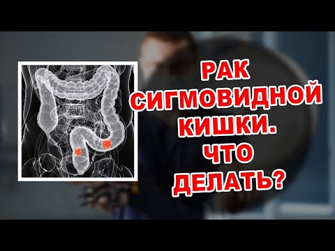 РАК СИГМОВИДНОЙ КИШКИ. ЧТО ДЕЛАТЬ?