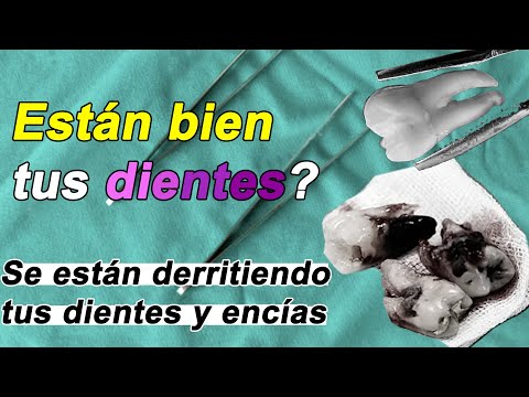 Tus encías y dientes están derritiendo cada día por <strong>no</strong> saber ni hacer <strong>ESTO</strong>
