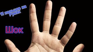 ШОК: 11 ПАЛЬЦЕВ НА РУКАХ ШОК: 11 ПАЛЬЦЕВ НА РУКАХ