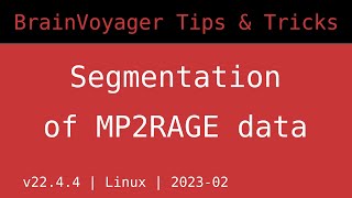 BrainVoyager Tips and Tricks - Segmentation of MP2RAGE 7 T MRI data