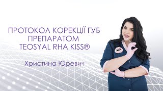 Протокол корекції губ препаратом TEOSYAL RHA KISS®. Христина Юревич