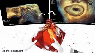 Ultrasound and Angiography Import to Virtual Reality