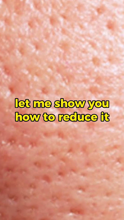 Suffering from textured skin?