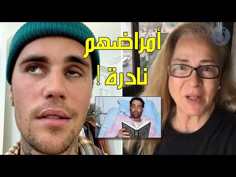 مشاهير عانوا امراضا نادرة