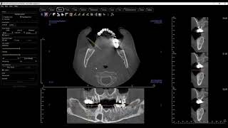 Invivo 6 - ArchSection View Tab