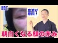 【驚愕!】顔の赤みの原因(動画アドバイス)