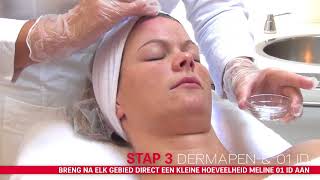 MELINE ID BEHANDELING