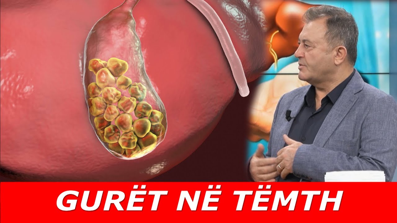 Ja si t’i shkrish GURËT NË TËMTH natyralisht! Ylli Merja: Ju tregoj 'sekretin'...