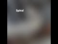 Spiral bandage application