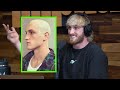 Logan Paul Embracing Balding? - "I'm Going To Be Bald"