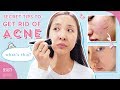 Banish CEO's Acne Story on How to Clear Hormonal Acne, Scarring & Hyperpigmentation (ft. Daisy Jing)