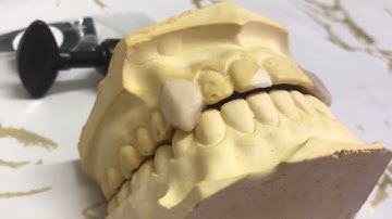 DIY Vampire Fangs Custom Fit Professional Dental Grade Quality Cosplay/Halloween/Anime Fun and Easy!