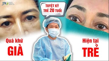 Bác sĩ Tú Dung BẬT MÍ tuyệt kỹ Treo chân mày nội soi 4X TRẺ 20 tuổi cho chị em tuổi TRUNG NIÊN