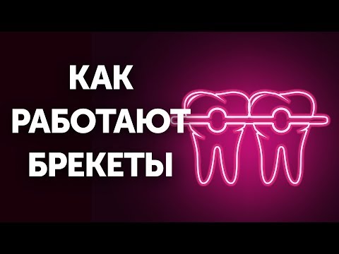 Как работают брекеты (и почему так медленно)