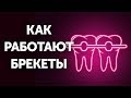 Как работают брекеты (и почему так медленно)