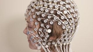 EEG brain tests help patients overcome depression