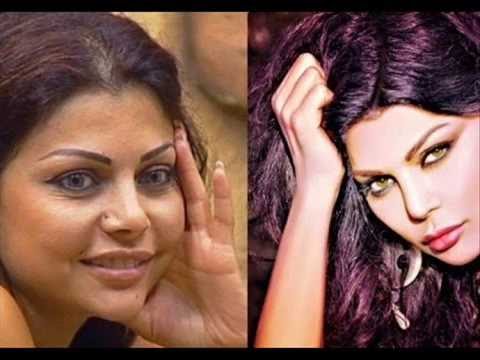 صور الفنانين قبل وبعد عمليات التجميل منهم ما لم تصدق عينيك عندما تراه