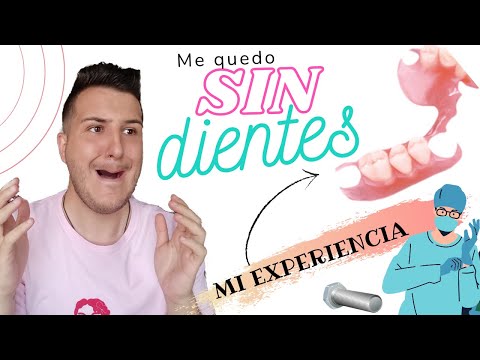 ME QUEDO SIN DIENTES 😭 MI EXPERIENCIA CON PRÓTESIS DENTAL REMOVIBLE 🦷 ¡LO CUENTO TODO!