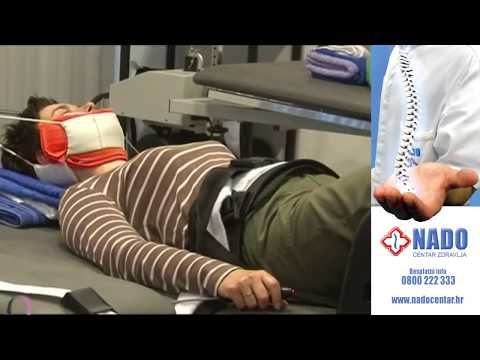 Video: Uncovertebralna Artroza - Liječenje, Artroza Vratne Kralježnice