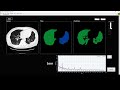 LabVIEW deep learning toolkit Medical U-Net multi class (256x256) in action