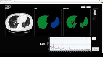 LabVIEW deep learning toolkit Medical U-Net multi class (256x256) in action