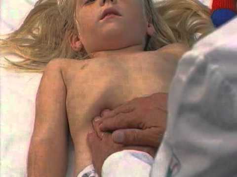 ImedrxTv The Video Blog  Examination of Child Abdomen