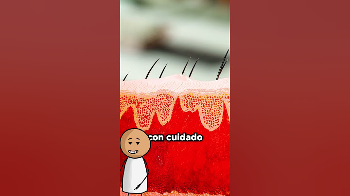 COMO QUITAR UNA GRAPA DE TUS DEDOS #shorts
